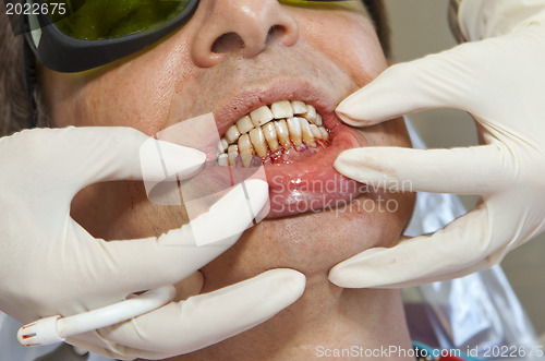 Image of Visit to the dentist. Dentist at work in dental room