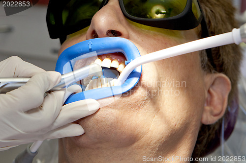 Image of Visit to the dentist.