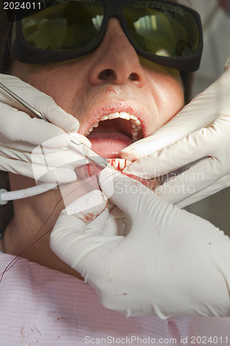 Image of Visit to the dentist. Dentist at work in dental room