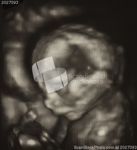 Image of Ultrasonography Analysis of a 4th Month Fetus