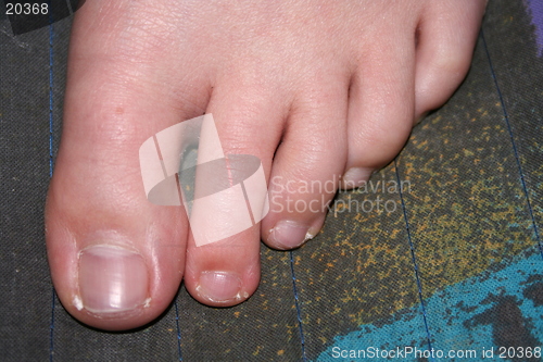 Image of Toes