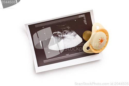 Image of ultrasound photo with pacifier
