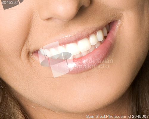 Image of Healthy woman teeth and smile