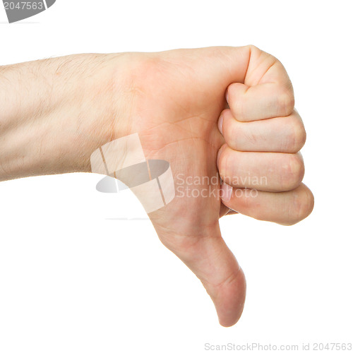 Image of Image of a mans hand showing thumb