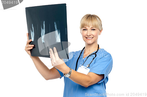 Image of Lady surgeon holding up x-ray report