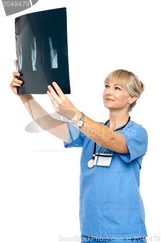 Image of Orthopedic surgeon holding up x-ray to analyze