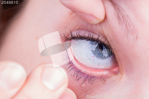 Image of Close up of inserting a contact lens