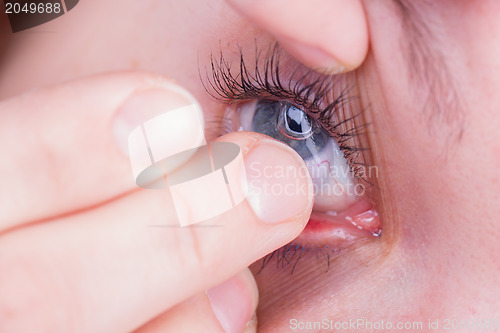 Image of Close up of inserting a contact lens