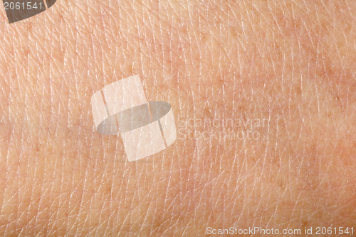 Image of Human skin