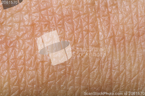 Image of Human skin