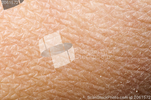 Image of Human skin