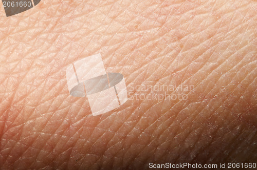 Image of Human skin