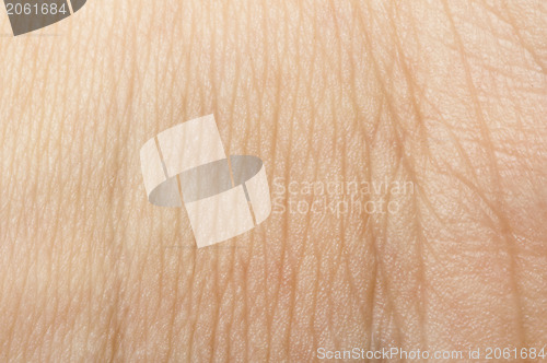 Image of Human skin