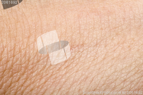 Image of Human skin