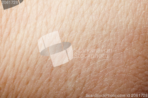 Image of Human skin