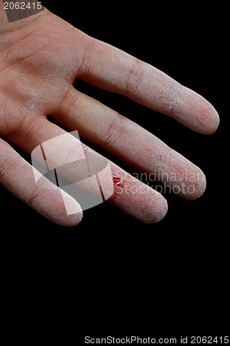 Image of Hurt hand