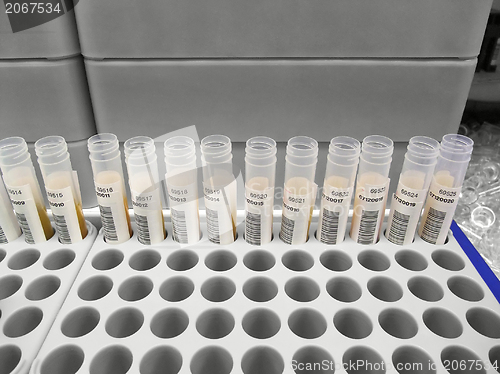 Image of serologic assays