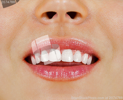 Image of woman teeth