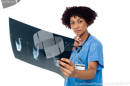 Image of Young serious lady surgeon holding x-ray sheet