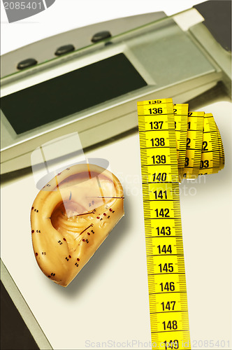 Image of acupuncture for weight loss