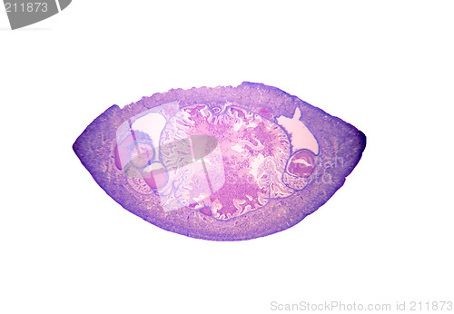 Image of Photomicrograph of the medicinal leech (Hirudo medicinalis)