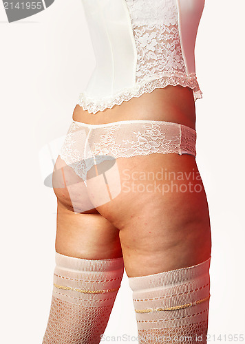 Image of buttocks with cellulite