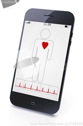 Image of mobile diagnostic