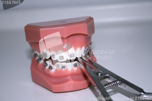 Image of Teeth with braces and dental instrument 