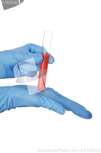 Image of blood test