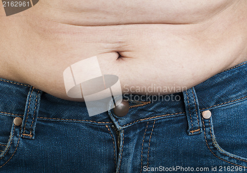 Image of Woman pinching fat from her abdomen
