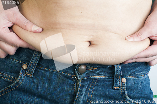 Image of Woman pinching fat from her abdomen