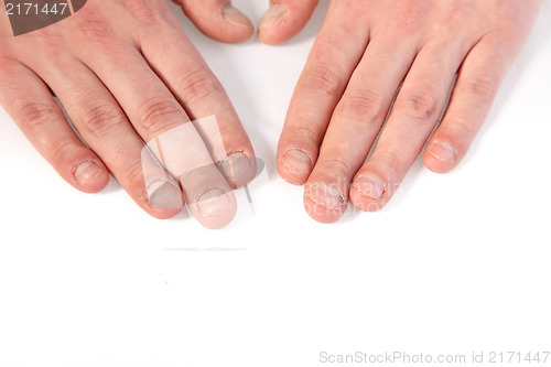 Image of Finger nails