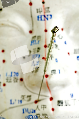 Image of Acupuncture needle on head model