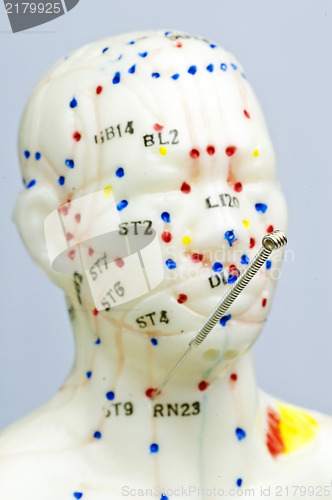 Image of acupuncture demonstration on model 