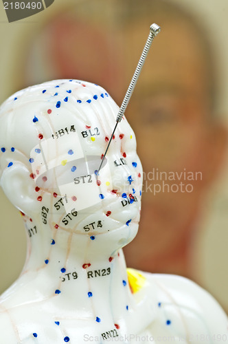 Image of acupuncture demonstration on model 