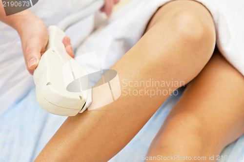 Image of laser epilation