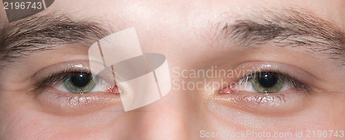 Image of Eyes