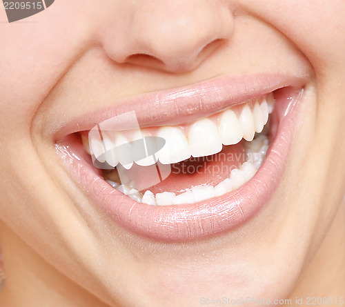 Image of healthy teeth