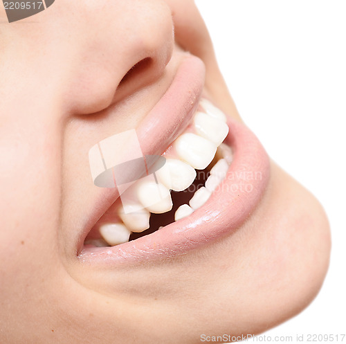 Image of healthy smile