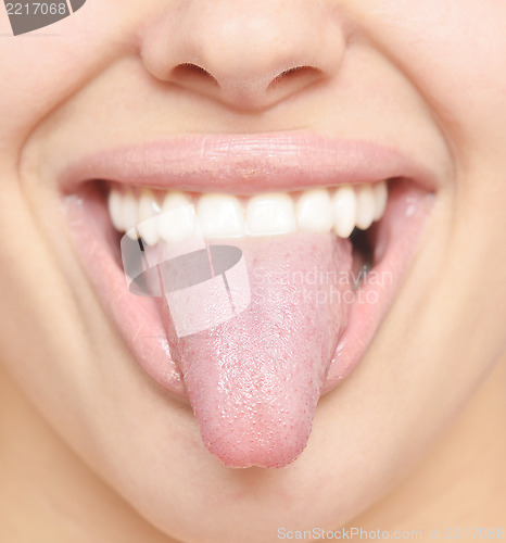 Image of healthy tongue