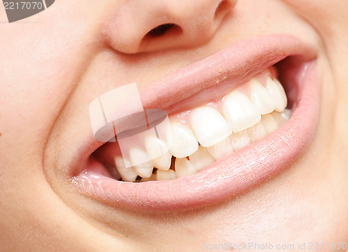 Image of healthy teeth