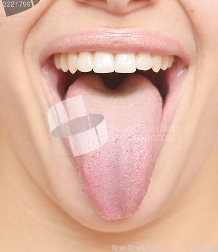 Image of healthy tongue