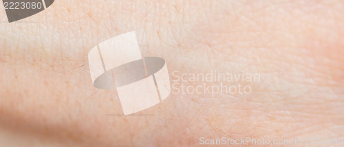 Image of human skin