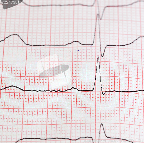 Image of cardiogram