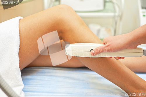 Image of laser epilation