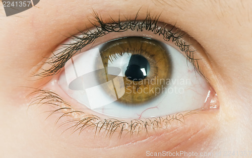 Image of Human eye