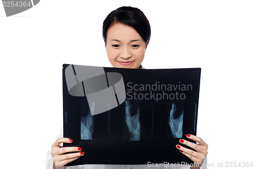 Image of Female doctor analyzing patient's x-ray report