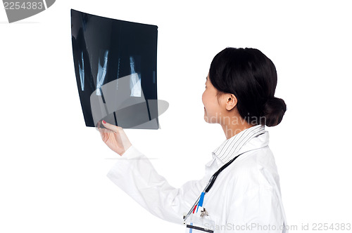 Image of Female doctor looking at scanned x-ray report