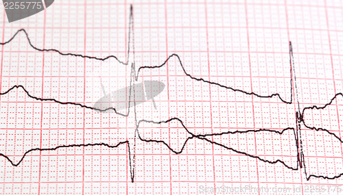 Image of cardiogram