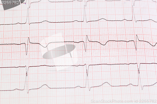 Image of cardiogram